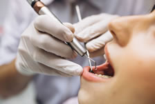 Periodontia, doenças Gengivais e Periodontais. Clínica Sorrio - ProdutosRio.com.br